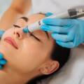 Carbon Facial Treatment: Benefits, Process & Results Explained