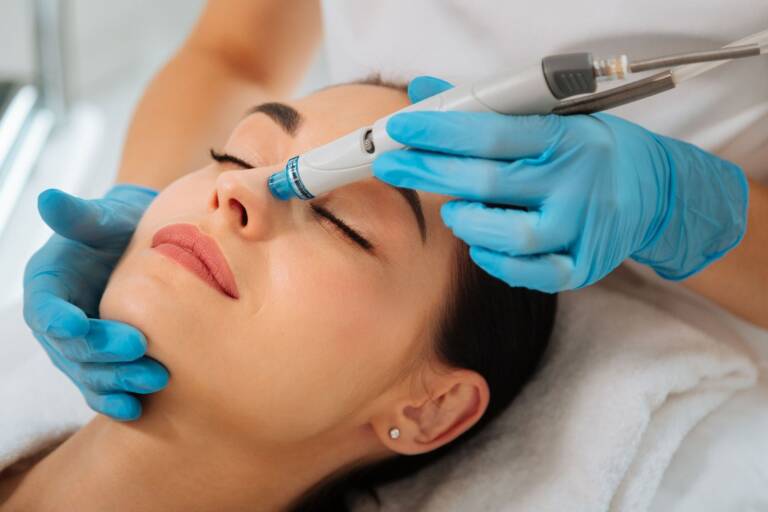 Carbon Facial Treatment: Benefits, Process & Results Explained