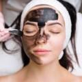 Carbon Facial Treatment: Benefits, Process & Results Explained